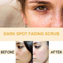 Turmeric Skin Care Set Hydrating Moisturizing Cleanser Refreshing Oil Control Subtle Lines Nourishing Cleansing Set