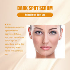 Dark Spot Serum, Hydrating Moist Firming Facial Skin Repair Skin Dark Bright Skin Care Essence