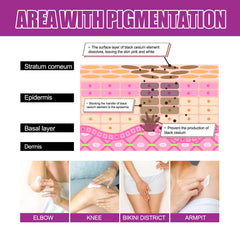 Skin Firming Cream, Brightening Skin Melanin Removal Brightening Skin Moisturizing Cream