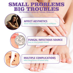 Gray Nail Care Spray Soft Ingrown Nails, Ingrown Nails, Yellowing And Thickening Cleaning Care