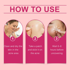 Repair Acne Patch, Facial Cleansing Cover Acne Skin Moisturizing Gentle Skin Cream