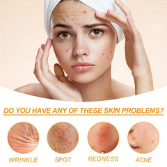 Facial Treatment Essence, Lighten Facial Acne Mark Oil Control Firming Skin Essence