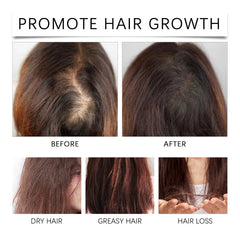Palm Oil Hair Care Essence, Scalp Massage Treatment Repair Dry Hair, Soft And Solid Hair