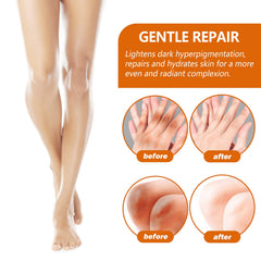 Acanthosis Nigricans Repair Essence, Brightening Skin Repair Skin Beauty Essence Underarm Joint Black Whitening