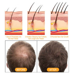 Ginger Juice Moisturizes Hair, Moisturizing And Repairing Hair Follicle Hair Strong Anti-Shampoos