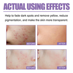 Lavender Oil Control Acne-Cleansing Soap For Cleansing Facial Skin Pores Oil Control Acne-Moisturizing Cleansing Soap