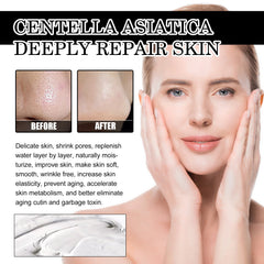 Remove Blackheads Peel Nose Mask, Deep Clean Remove Blackheads Acne And Tighten Pores Strawberry Nose Mask