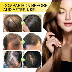 Black Seed Oil Essence To Improve Dry Hair, Nourish And Repair Damaged Hair And Prevent Hair Loss