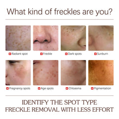 Peel Mask, Removing Spots Hydrating Firming And Brightening Skin Mask