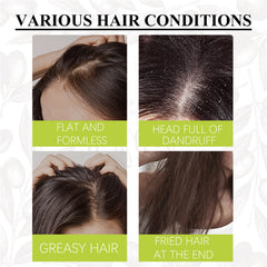 Artemisea Anti-Dandruff Scalp Pigment, Clean Scalp, Relieve Itching And Oil Control, Repair Frizz Damaged Hair Care