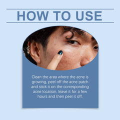Moon Acne Patch Repair Acne Skin Breathable Facial Skin Gentle Cleansing Patch
