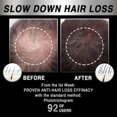 Moving Hair Growth Treatment, Repair Frizzy, Smooth And Dense Hair Scalp Care Heating Massage Cap