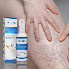 Intravenous Massage Spray For Varicose Veins Relief And Earthworm Leg Blood Vessel Bulge Pain Spray