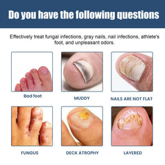 Nail Care Spray Gently Cleans Foot Nails Moisturizing And Brightening Nail Care Spray
