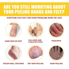Horse Oil Hand And Foot Repair Cream, Chapped Skin Care Moisturizing And Anti-Peeling Repair Cream