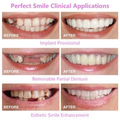 Upper Teeth And Lower Teeth Simulation Braces Non-Porous Braces Whitening Sleeves Second-Generation Silicone Simulation Teeth Dentures