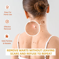 Anti-wart Essence, Anti Warts Fade Moles Corns Smoothing Skin Care Essence
