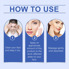 Herbal Acne-Clearing Cream Face Refreshing Oil Control Gentle Pore Cleansing Cream