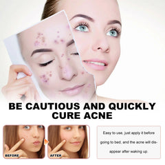 Sea Life Pattern Acne Patches, Lighten Acne Acne Repair Facial Skin Concealer Acne Patch