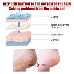 Exfolating Foot Mask, Tender Skin To Moist Calluses To Exfoliate Dead Skin Hydrating Foot Care