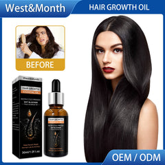 Hair Growth Essential Oil, Dense Hair Growth Repair Dry Hair And Moisture Hair Essence