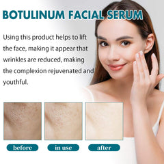 B5 Face Capsule Essence Reduces Fine Lines, Lifts Sagging, Firming And Moisturizing Face