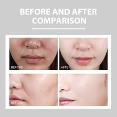 Hydrating Cream Hydrating And Lightening Facial Acne Repair Redness Hydrating And Brightening Moisturizing Cream