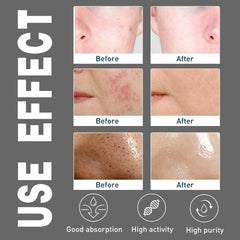 Men's Amino Acid Oil Control Face Wash, Deep Clean Acne Print Delicate Pores Whitening Brightening Skin