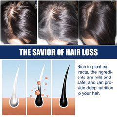 Alopecias Hair Growth Cream, Protect Hair Follicles Strong Moisturizing Thick Hairline Hair
