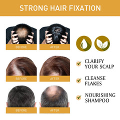 Shampoo Bar, Solid Hair Tight Hair Anti-Loss Soft Repair Hair End Dry Damaged Shampoo Soap