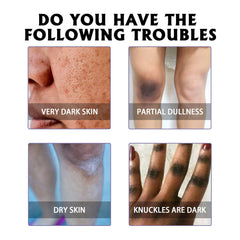 Whitening Skin, Lighten Dull Skin Elbow Black Hydrating, Brightening, Moisturizing And Rejuvenating Essence