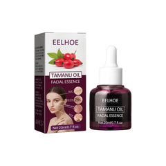 Tamanu Facial Oil, Relieves Acne Marks Fine Lines Moisturizes and Firms Skin Essential Oil