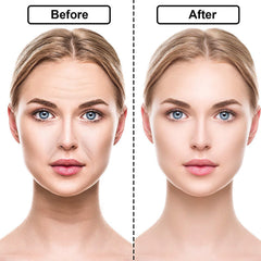 18pcs Silicone Anti-Wrinkle Sticker Tight Wrinkle-Removing Anti-Wrinkle Silicone Beauty Sticker Law Line Sticker Eye Sticker Chest Sticker