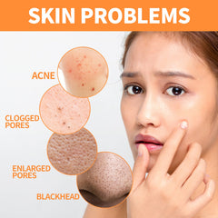 Ginger Yellow Mud Facial Mask Stick, Acne Removing Pore Shrinking Cleaning Solid Facial Mask