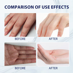 Aloe Vera Care Gel, Hydrating And Refreshing Moisturizing Cream Prevents Dryness And Cracks To Repair Hand Skin