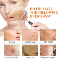 Papaya Whitening Freckle Cream Lightens Dark Spots On The Face, Brightens And Moisturizes The Skin Early And Late