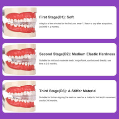 Transparent braces, exercise braces, orthodontic treatment for adults, shape retention correction, night wear prevention