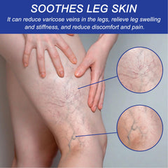 Vein Comfort Spray, Relief Leg Muscle Soreness And Swelling Earthworm Leg Vein Treatment Spray