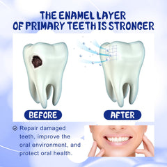 Anti-Cavity Toothpaste, Oral Cleaning Dental Yellow Caries Dental Care Gingival Reinforcement Dental Care Fresh Breath