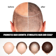 Hair Ampoule Serum For Dense, Volumizing, Moisturizing, Nourishing And Strengthening Hair