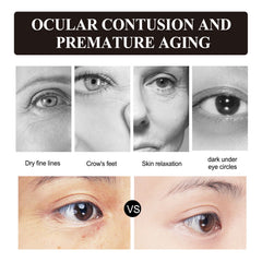 Retinol Eye Cream, Desalination Smoothen Fine Lines Eye Pouch Black Rim Of The Eye Moist Nursing Play Tight Muscle Eye Cream