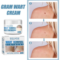 Wart Cream, Skin Clean And Smooth Wart Nevi Facial Care Cream