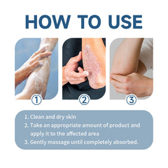 Moisturizing Cream, Moisturizing And Repairing Skin Care Cream For Itchy And Swollen Skin