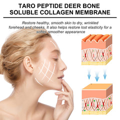 Collagen Membrane, Reduces Wrinkles, Smooths Forehead Fine Lines, Moisturizes And Tightens Skin Protein Membrane