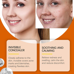 Facial Acne Patch, Repair Facial Acne Acne Facial Skin Care To Remove Facial Acne