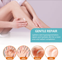 Black Acanthoderm Repair Cream Repair Underarm Arm Knee Joint Black Moisturizing Whitening Body Care Cream