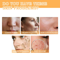 Glycolic Acid 7% Toner, Remove Acne Lighten Acne Repair Acne Mark Moisturize Skin Toner