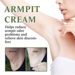 Armpit Cream, Whitening Whitening Treatment Cream To Reduce Skin Pigmentation And Moisturize Whitening Treatment