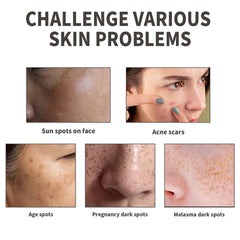 Dark Spot Serum, Fade Spot Moisturize Skin Repair Blain Mark Face Dull Shine Essence