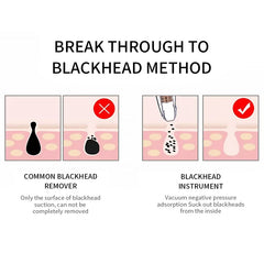 Blackhead Remover Face Deep Pore Cleaner Removal Vacuum Suction Facial SPA Diamond Beauty Care Tool Skin Care